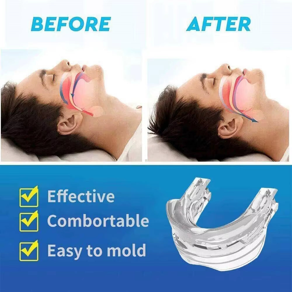 5/10/20PCS Anti-Snoring Mouth Cover Prevent Snoring Easy to Use Sleep/Stop Snoring Snorer Molar Anti-Snoring Device Snoring